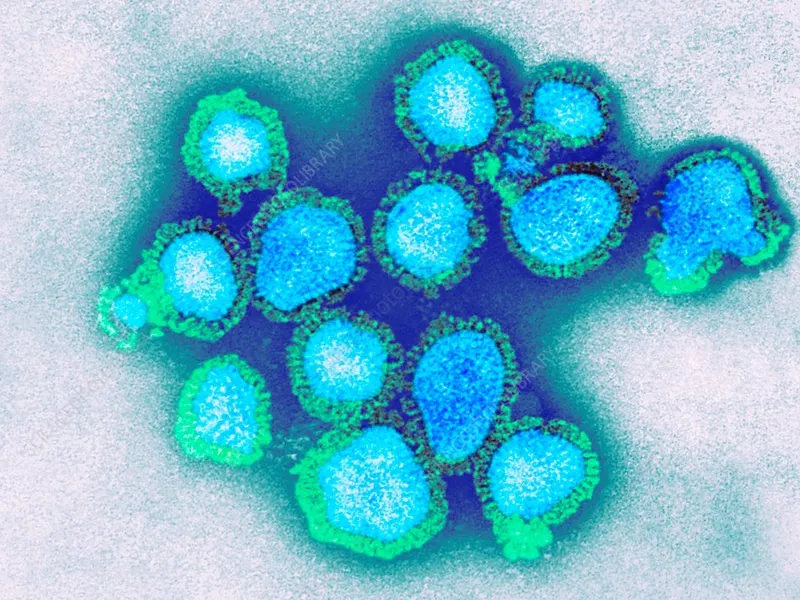 Confirman primer caso de influenza A(H3N2) en Chile: ¿Qué hacer y cómo prevenir contagios?