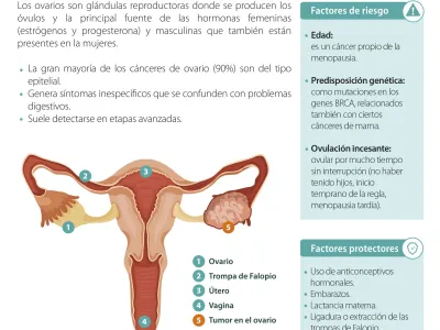 En el marco del día mundial de esta enfermedad: Aspectos claves del cáncer de ovario a los que prestar atención