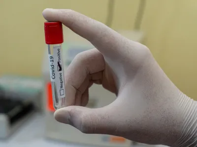 Encuestados reconocen efectos negativos de una alta exposición a información sobre COVID-19