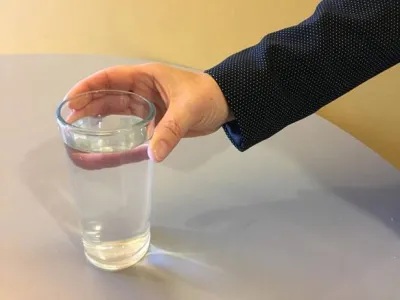 Enfermedades renales afectan al 40% de los usuarios del Programa Cardiovascular