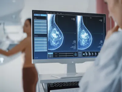 ¿Mamografía o autoexamen? Solo uno detecta precozmente el Cáncer de Mama