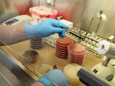 Medicina mapuche y salud pública trabajan contra la Tuberculosis