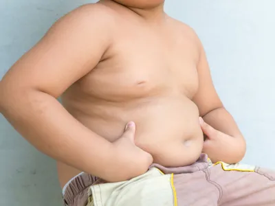 Obesidad: la punta de un iceberg sanitario que urge abordar