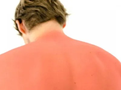Recomendaciones para vacaciones seguras: Lo que debes saber de Primeros Auxilios 